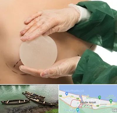 جراحی پروتز سینه در بندر انزلی