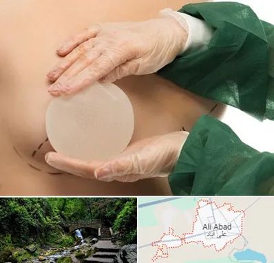 جراحی پروتز سینه در علی آباد کتول