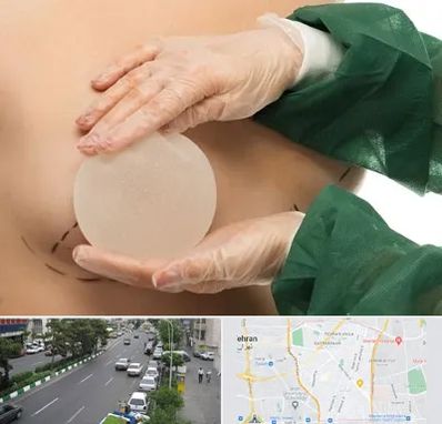 جراحی پروتز سینه در ستارخان