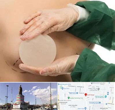 جراحی پروتز سینه در کارگر جنوبی