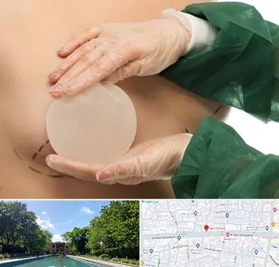 جراحی پروتز سینه در هشت بهشت اصفهان