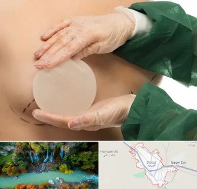 جراحی پروتز سینه در دورود