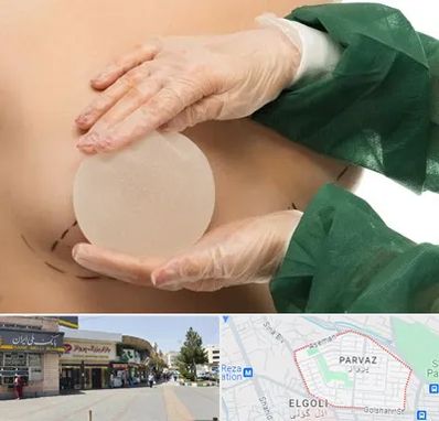 جراحی پروتز سینه در پرواز تبریز