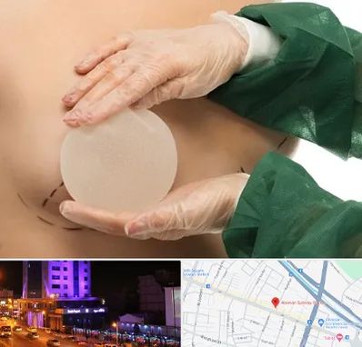 جراحی پروتز سینه در آبرسان تبریز