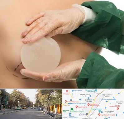 جراحی پروتز سینه در شریعتی