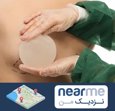 جراحی پروتز سینه در نزدیک من
