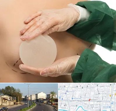 جراحی پروتز سینه در ضیابری رشت