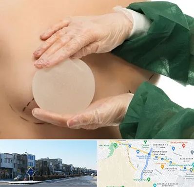 جراحی پروتز سینه در شریعتی مشهد