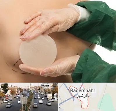جراحی پروتز سینه در باقرشهر