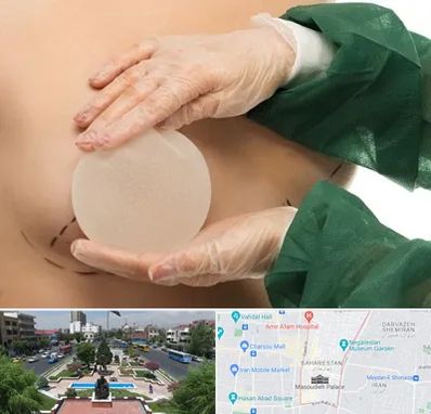 جراحی پروتز سینه در بهارستان