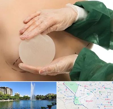 جراحی پروتز سینه در کوهسنگی مشهد