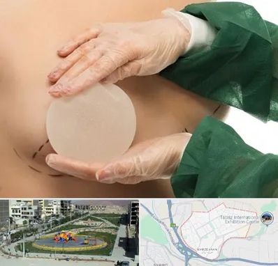 جراحی پروتز سینه در مرزداران تبریز