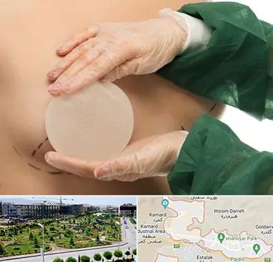 جراحی پروتز سینه در پردیس