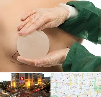 جراحی پروتز سینه در جنت آباد تهران