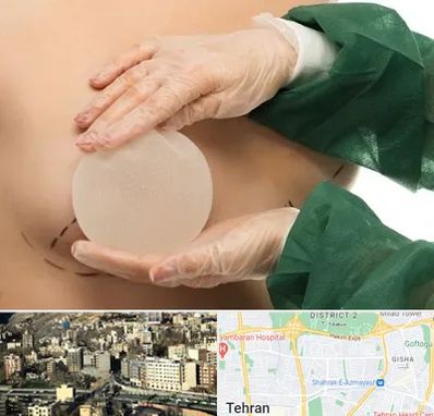 جراحی پروتز سینه در مرزداران