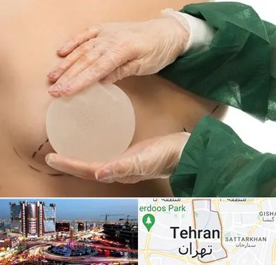 جراحی پروتز سینه در صادقیه