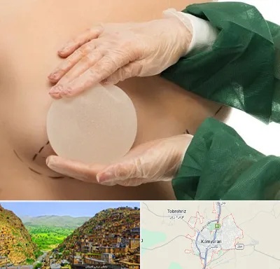جراحی پروتز سینه در کامیاران