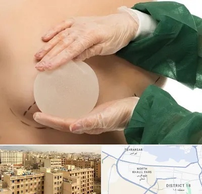 جراحی پروتز سینه در جنوب غرب تهران