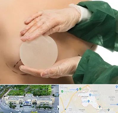 جراحی پروتز سینه در نسیم شهر