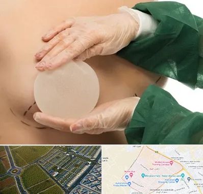 جراحی پروتز سینه در الهیه مشهد