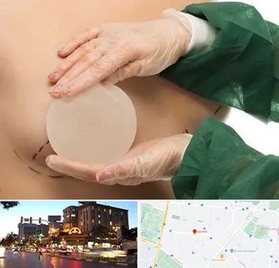 جراحی پروتز سینه در بلوار سجاد مشهد