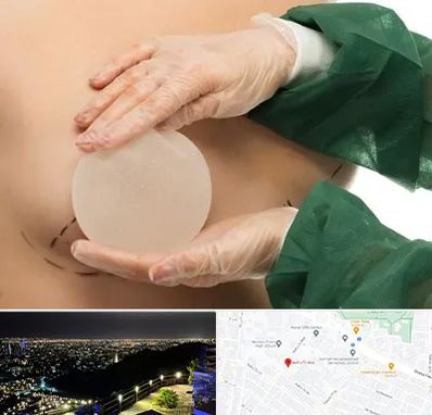 جراحی پروتز سینه در هفت تیر مشهد