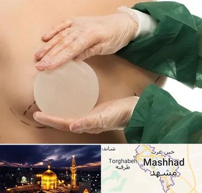 جراحی پروتز سینه در مشهد