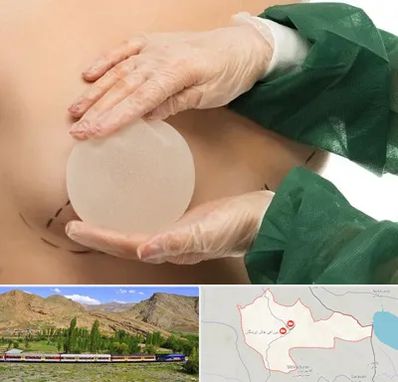 جراحی پروتز سینه در خاش