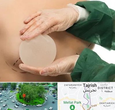 جراحی پروتز سینه در تجریش