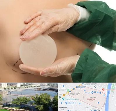 جراحی پروتز سینه در گلستان اهواز