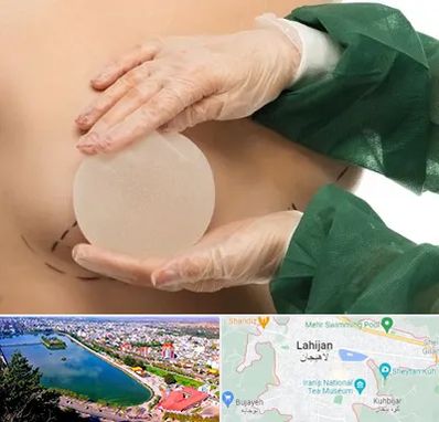 جراحی پروتز سینه در لاهیجان