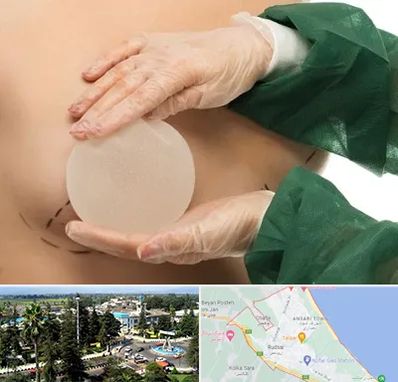 جراحی پروتز سینه در رودسر