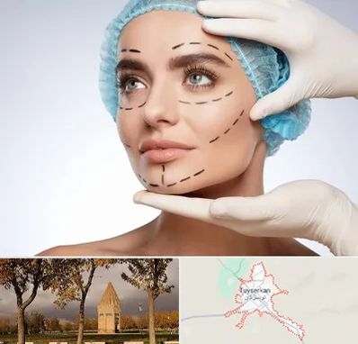 جراحی زیبایی در تویسرکان