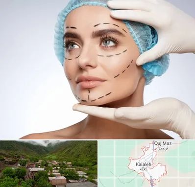 جراحی زیبایی در کلاله
