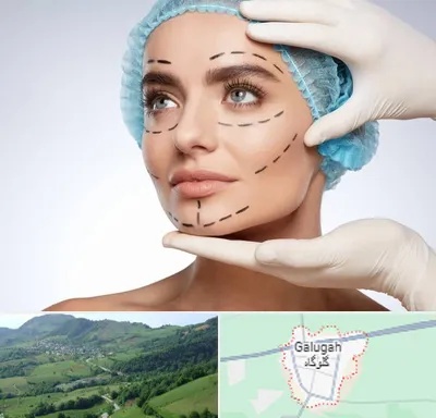 جراحی زیبایی در گلوگاه