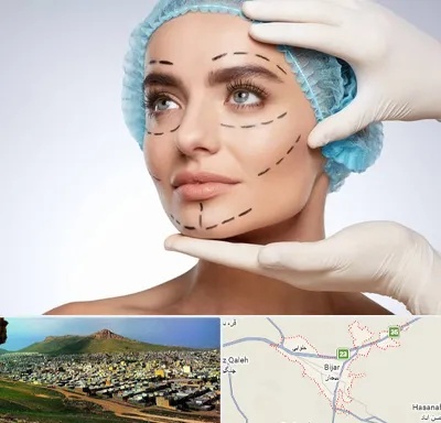 جراحی زیبایی در بیجار