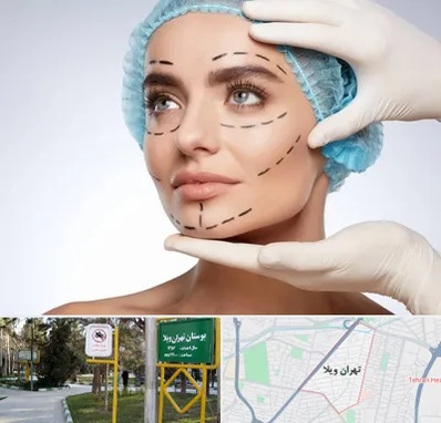 جراحی زیبایی در تهران ویلا