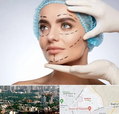 جراحی زیبایی در عظیمیه کرج