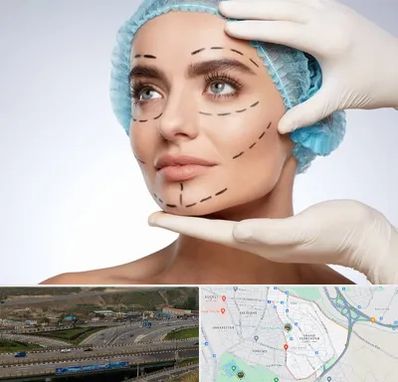 جراحی زیبایی در یاغچیان تبریز