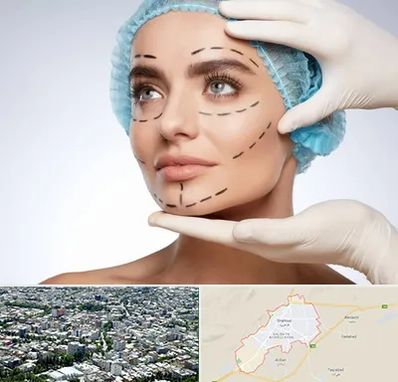 جراحی زیبایی در شاهرود