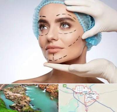 جراحی زیبایی در شوشتر