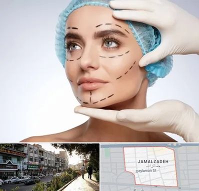 جراحی زیبایی در خیابان جمالزاده