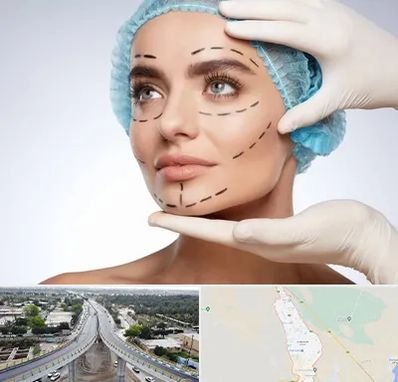 جراحی زیبایی در اندیمشک