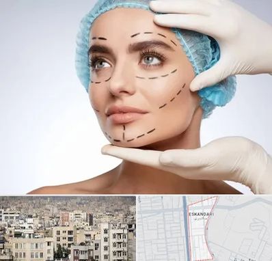 جراحی زیبایی در اسکندری