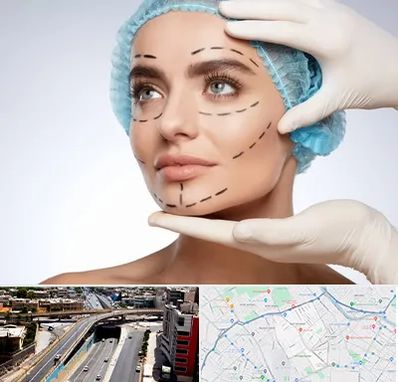 جراحی زیبایی در ستارخان شیراز