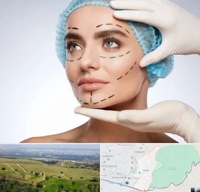 جراحی زیبایی در سوهانک