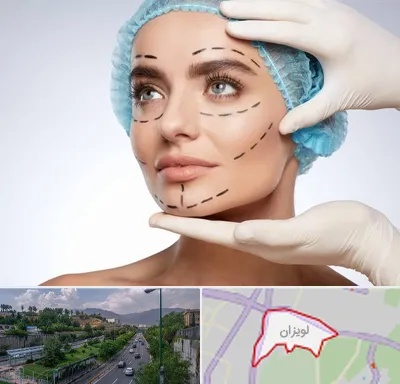 جراحی زیبایی در لویزان