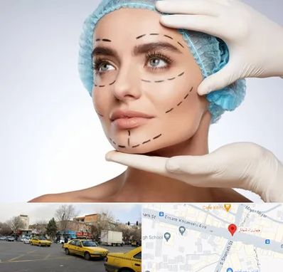 جراحی زیبایی در شهناز تبریز