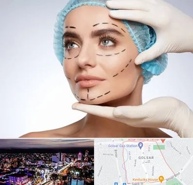 جراحی زیبایی در گلسار رشت