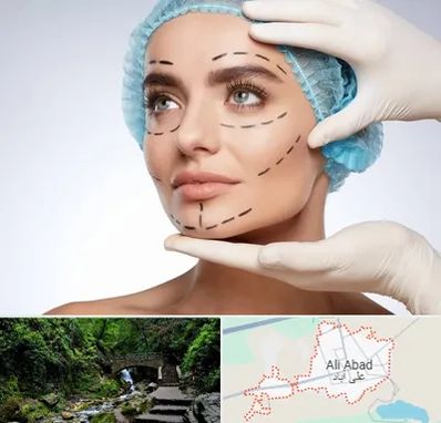 جراحی زیبایی در علی‌ آباد کتول